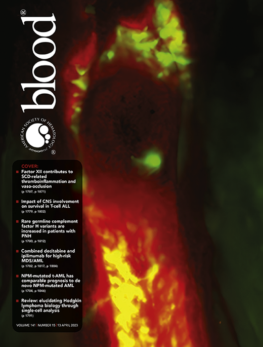 Ipilimumab plus decitabine for patients with MDS or AML in posttransplant or transplant-naïve settings